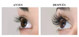 Antes y despues de tratamiento pestañas