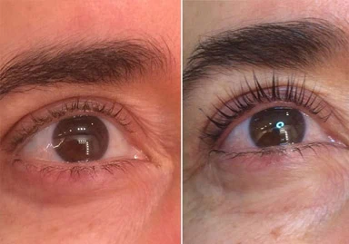 Lifting de Pestañas