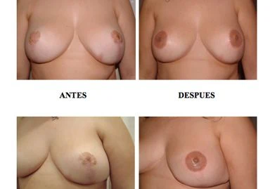 micropigmentacion paramedica