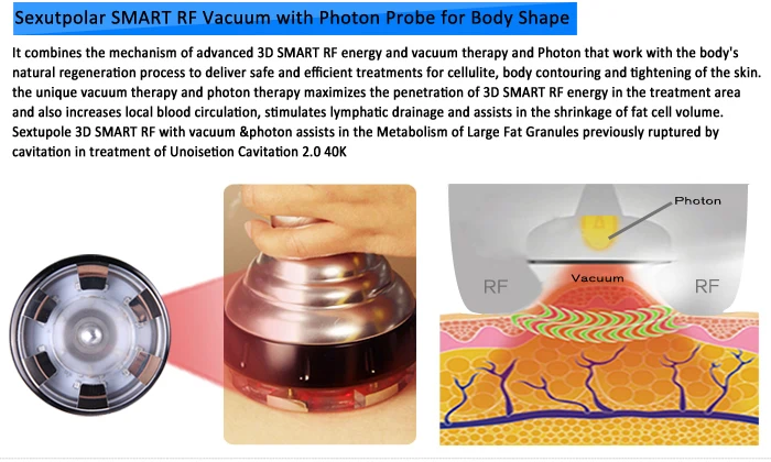 Funcionamiento Radiofrecuencia Corporal